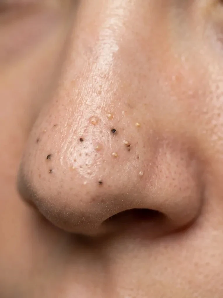 Woman enjoying a soothing facial treatment