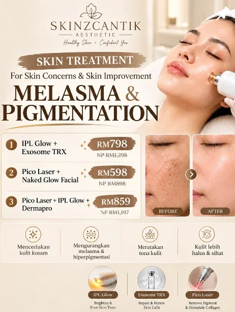 Pigmentation & melasma care in Melaka at Skinz Cantik Melaka