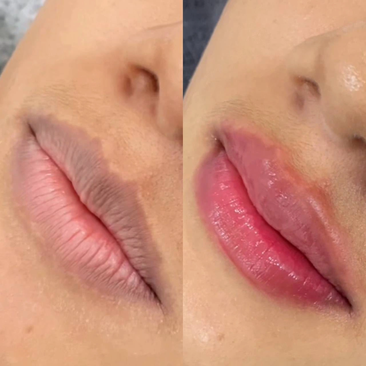 SkinzCantik lip care comparison