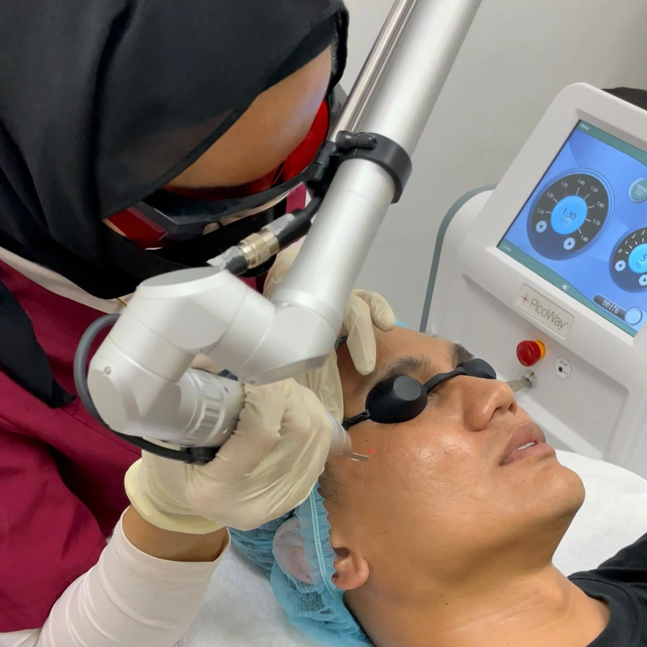 SkinzCantik facial device treatment